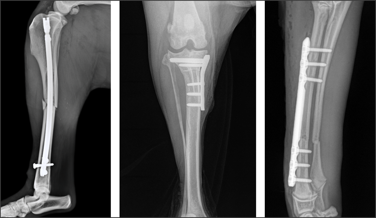 Securos Orthopedics X-Ray