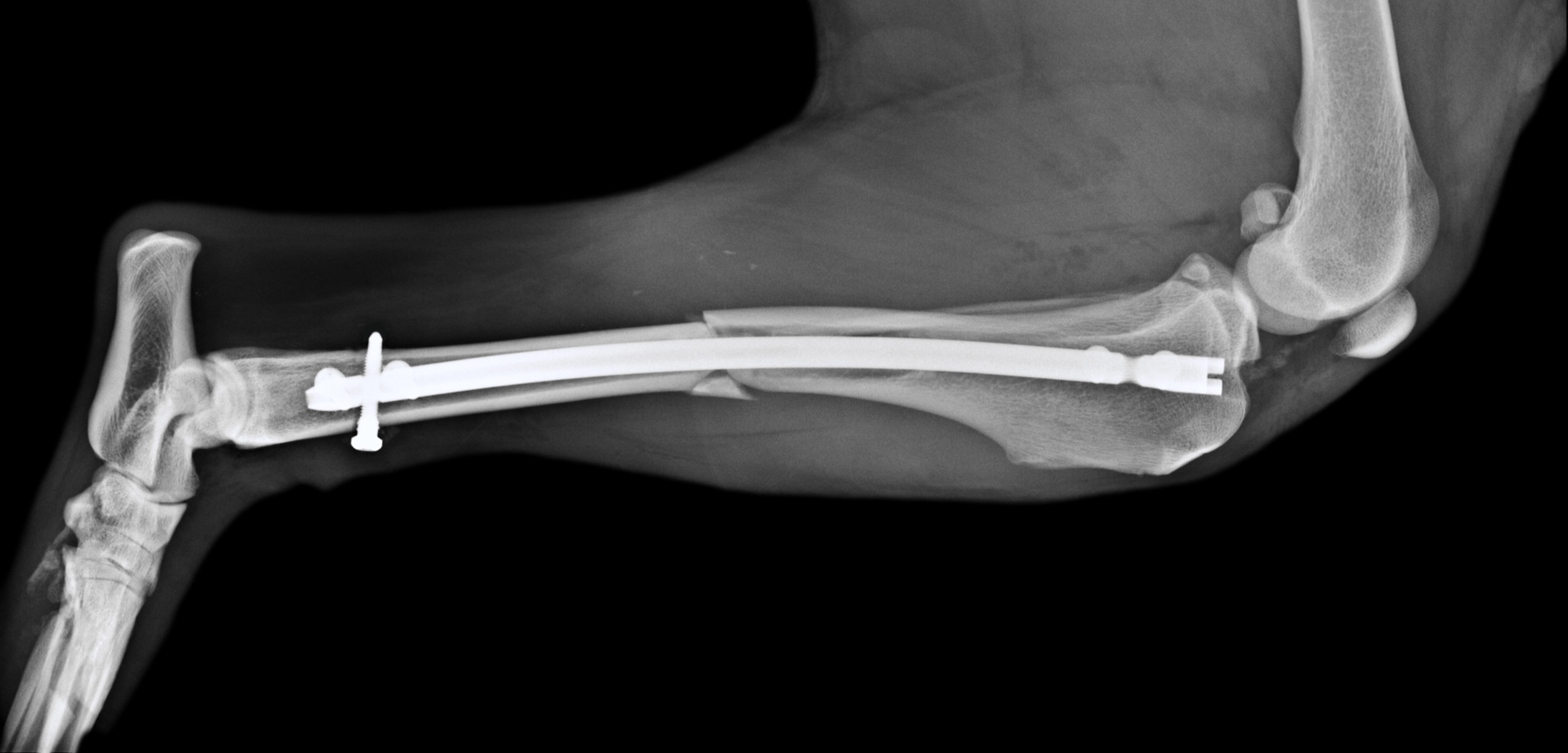 xray of tibia