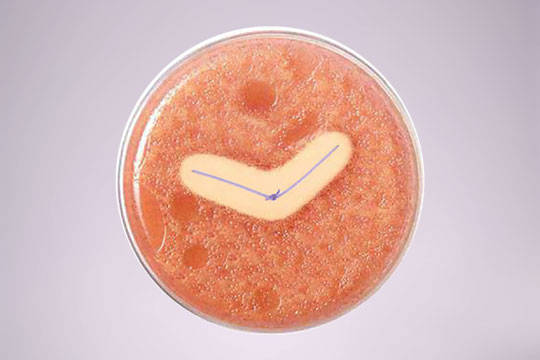 Microscopic picture of bacteria